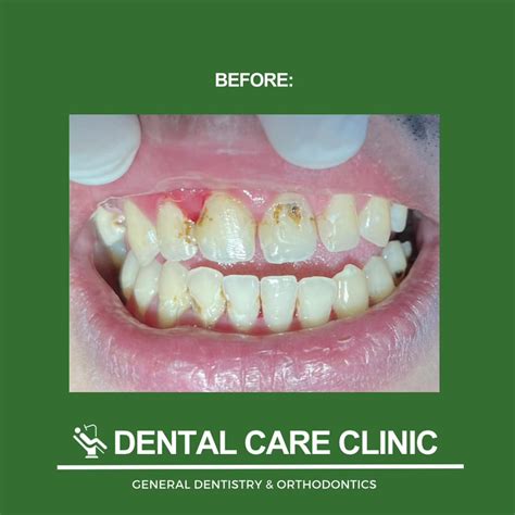 pasvil dental care clinic|Pasvil Dental Care Clinic (Dentists) at M. Concepcion Avenue, .